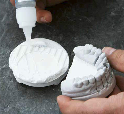 High strength super glue used to bond teeth onto a dental casting